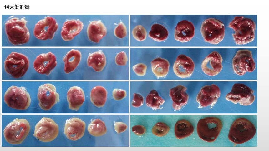 TTC染色详细计算分析过程，步骤详解（组图）