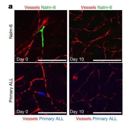 【前沿资讯】Nature：癌细胞竟能用这种方法入侵中枢神经系统