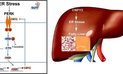 神秘蛋白质引发代谢紊乱分子机制