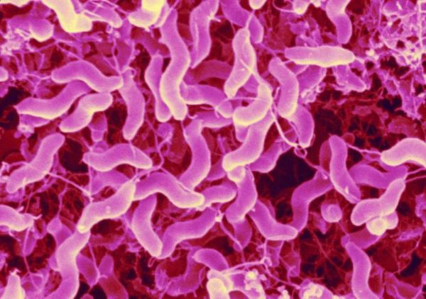 几种分离空肠弯曲菌的方法介绍