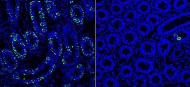 男性不育研究新发现！单一蛋白或能控制精子发育过程中数千个基因的表达