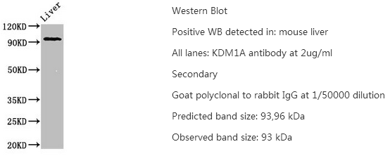 组蛋白去甲基化酶LSD1