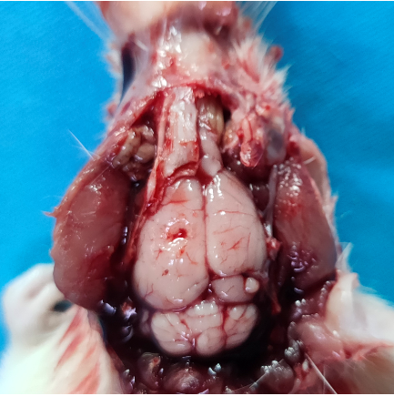 大鼠脑外伤动物模型（TBI）的建立