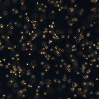 浙江美森-急变期慢性粒细胞白血病 LAMA84