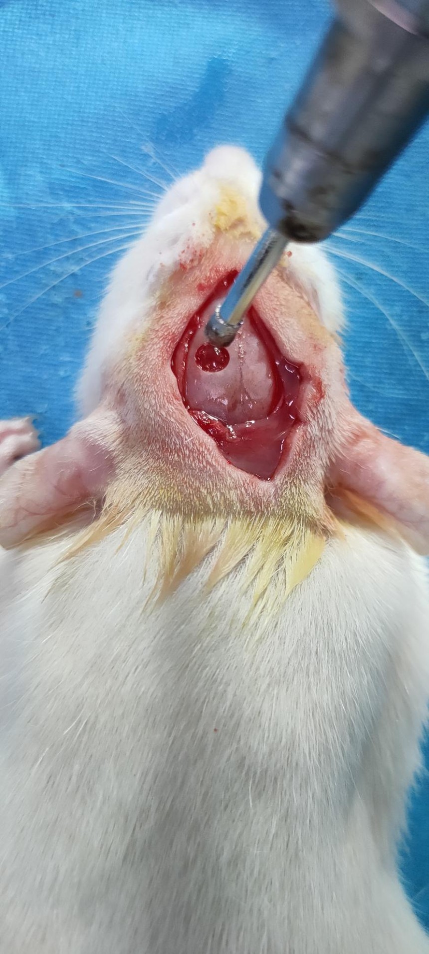 大鼠脑外伤动物模型（TBI）的建立