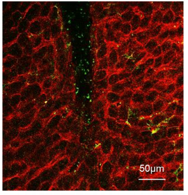 厉害了，鼠的肺！！！