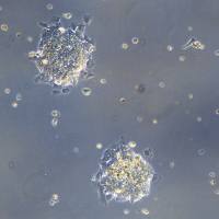 浙江美森-人尤文氏肉瘤 RD-ES