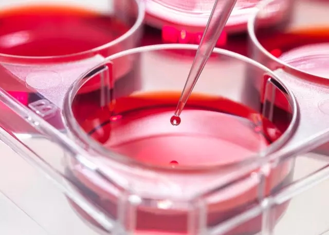 如何选购胎牛血清