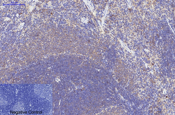 Bax抗体 IHC结果图