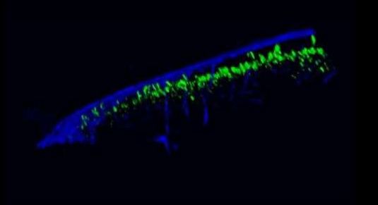 盘点这些年那些HIV快速检测的创新性技术-齐一生物