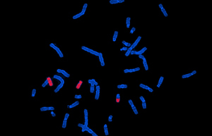 荧光原位杂交服务