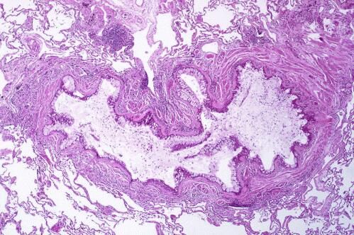 Nat Commun：突破！科学家成功实现沉默免疫细胞的功能来治疗过敏症！