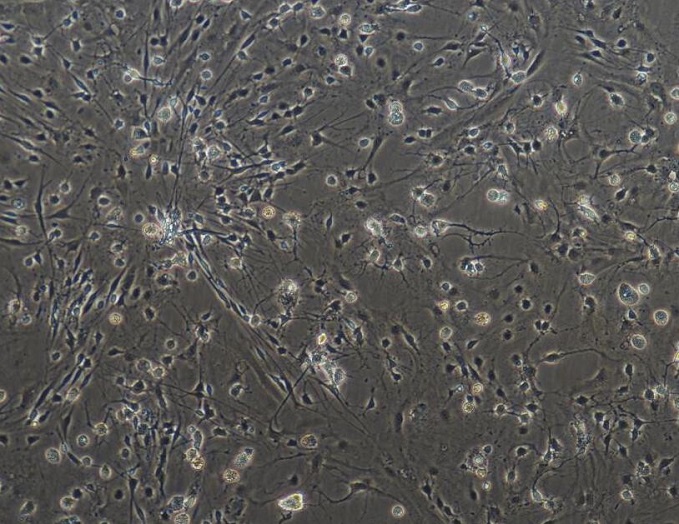 实验过程中遇到的不增殖细胞有哪些