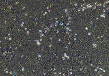 分离和培养方法原代小鼠心肌成纤维细胞的方法有哪些？