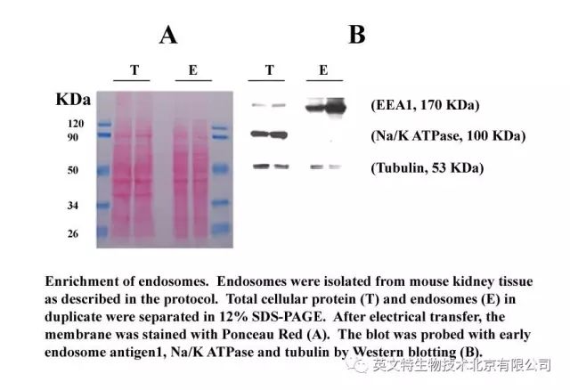 神秘的内体—内吞转运的来龙去脉