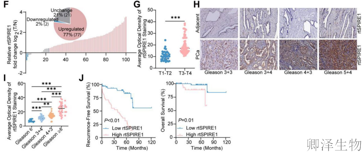 【circRNA翻译】 | 环状RNA编码新型蛋白，成前列腺癌治疗新靶点！