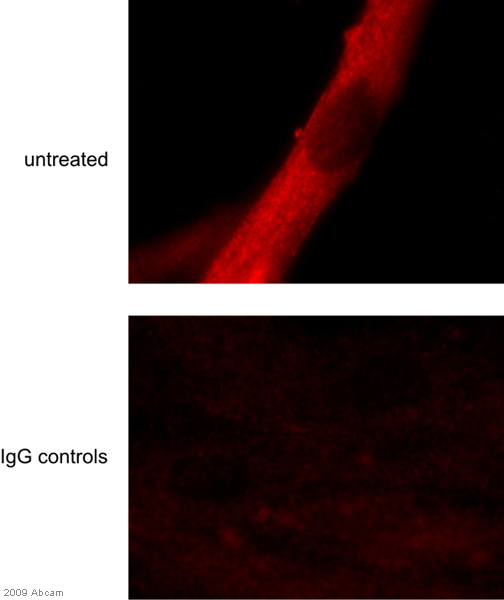 Immunocytochemistry/ Immunofluorescence - Anti-Bax antibody [6A7] (ab5714)
