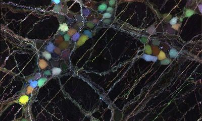 新型病毒载体可以将“货物”在大脑与外周神经中自由运输