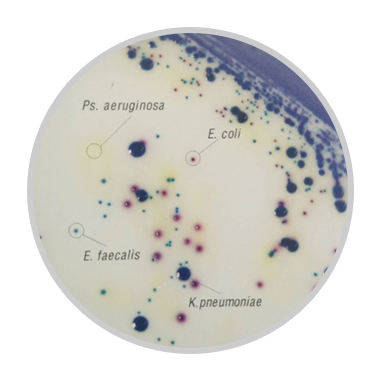 更高效的尿道感染病原菌分离培养及鉴定