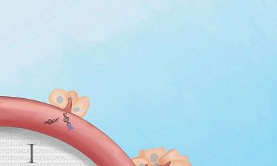 新型血液DNA检测手段可用于早期癌症的鉴定