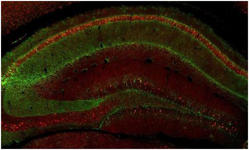 【前沿资讯】Science：重磅！发现重写创伤记忆的神经元