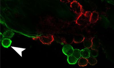 眼球对免疫系统并不是完全“免疫”的