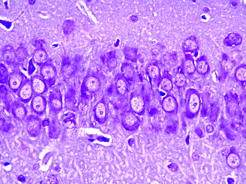 大鼠脑外伤动物模型（TBI）的建立