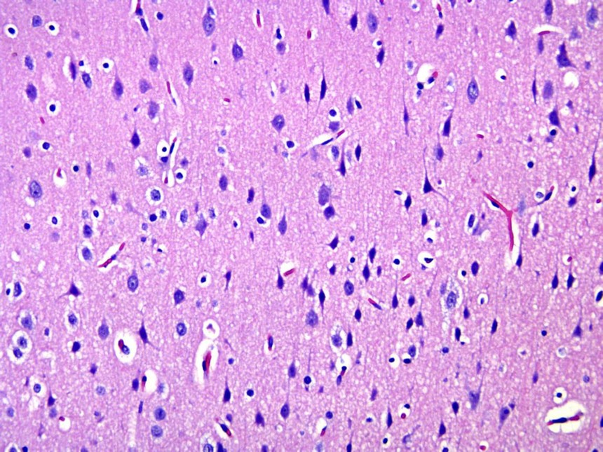 大鼠脑外伤动物模型（TBI）的建立