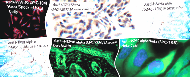 热休克蛋白之光，HSP90抗体