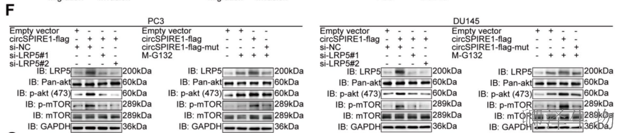 【circRNA翻译】 | 环状RNA编码新型蛋白，成前列腺癌治疗新靶点！