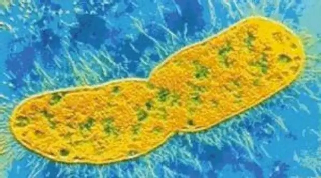 珍贵细胞被细菌污染了怎么办?