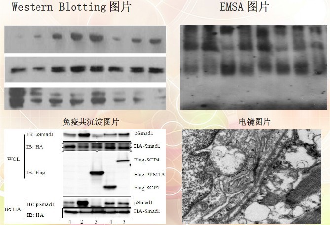 Western blotting技术服务，WB实验代测