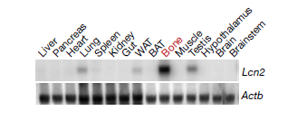 脂质运载蛋白2（LCN2）新发现