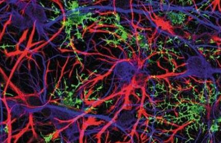 研究发现激活促炎性星形胶质细胞活性的免疫代谢机制