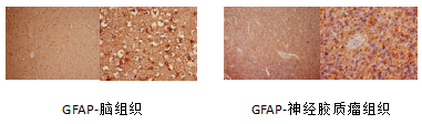 神经胶质纤维酸性蛋白（GFAP）单克隆抗体