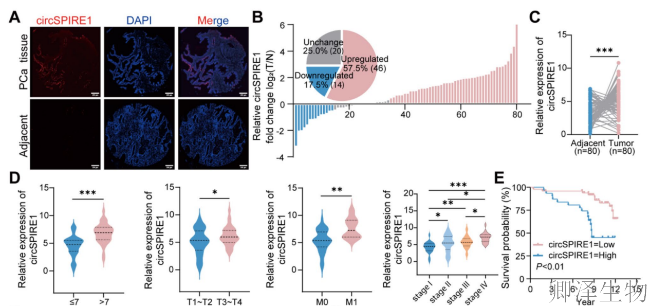 【circRNA翻译】 | 环状RNA编码新型蛋白，成前列腺癌治疗新靶点！