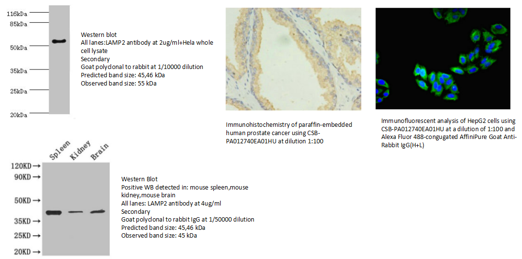 我的后半生——自噬