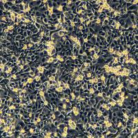 浙江美森-子宫内膜腺癌细胞 SNGM