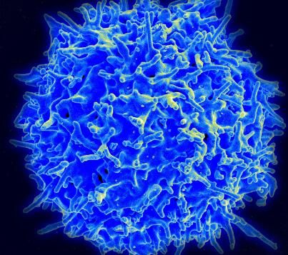 揭示T细胞在人类大脑中扮演的关键角色！