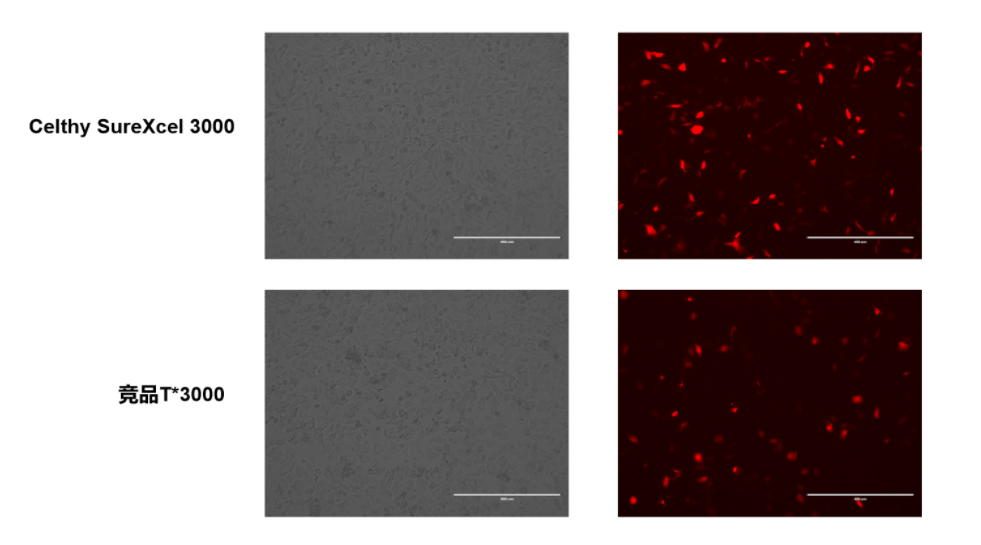Celthy SureXcel 3000转染试剂——高效、温和、广谱的基因递送解决方案!