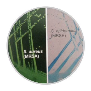 金葡与表葡耐药菌的特异性区分及鉴别