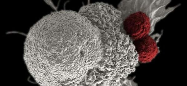 【前沿资讯】CAR T疗法新突破！Nat Med背靠背发表两个研究团队发现避免细胞因子风暴的新方法