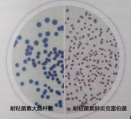 危险的耐药致命菌—粘菌素耐药菌