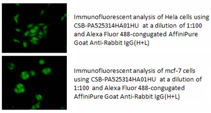 组蛋白去甲基化酶LSD1