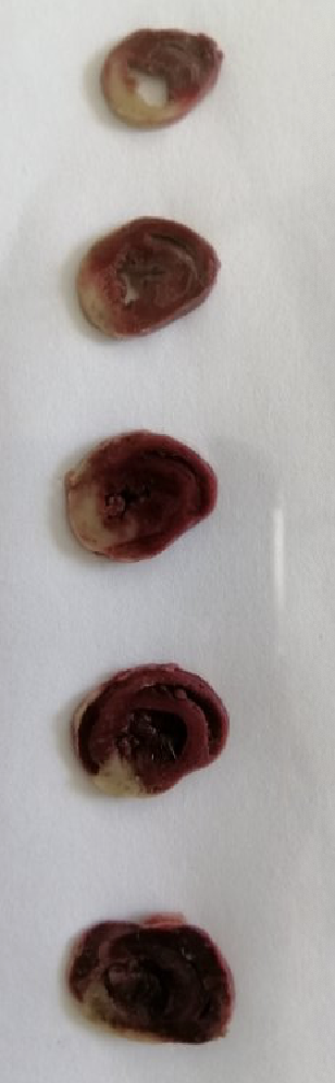 大鼠心肌缺血再灌注模型制备 大鼠心肌缺血再灌注模型制备