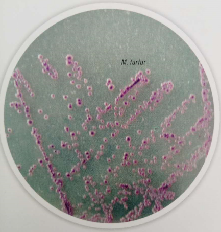 可引起皮肤角质层和毛囊感染的真菌—马拉色菌