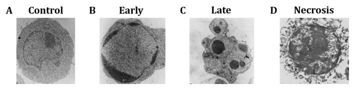   电镜下细胞凋亡形态变化