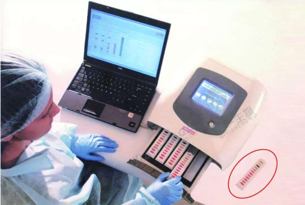 进口到货通知！微生物检测、叶酸检测等大批到货啦！