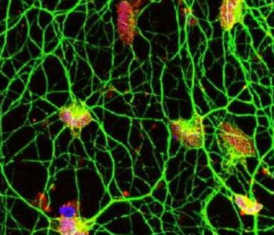 损害大脑的有毒免疫细胞的综合分子谱