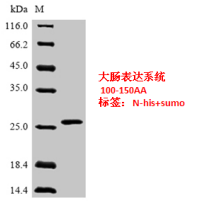 组蛋白去甲基化酶LSD1